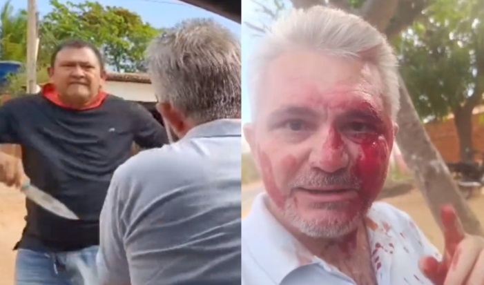 Brutalidade: Vereador “Carlão” do PT tenta matar jornalista a facadas no Piauí